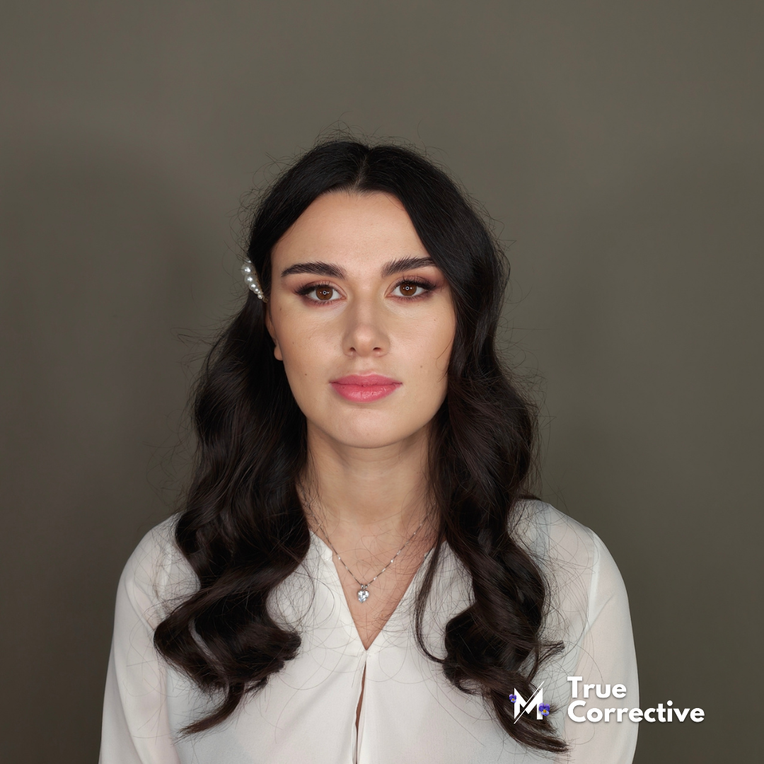 True Corrective Corso Make Up Online Vitiligine e pelle super secca